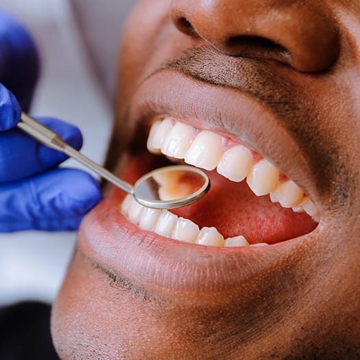 Close up of man receiving a preventive dentistry checkup in Mineola