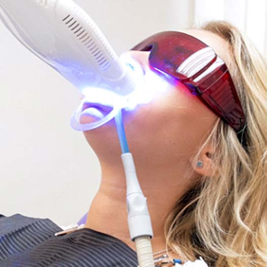 Woman receiving professional teeth whitening in dental chair