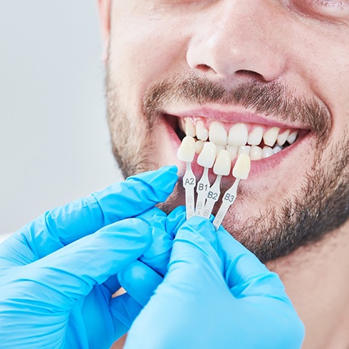 Dentist holding shade guide next to a smiling patient