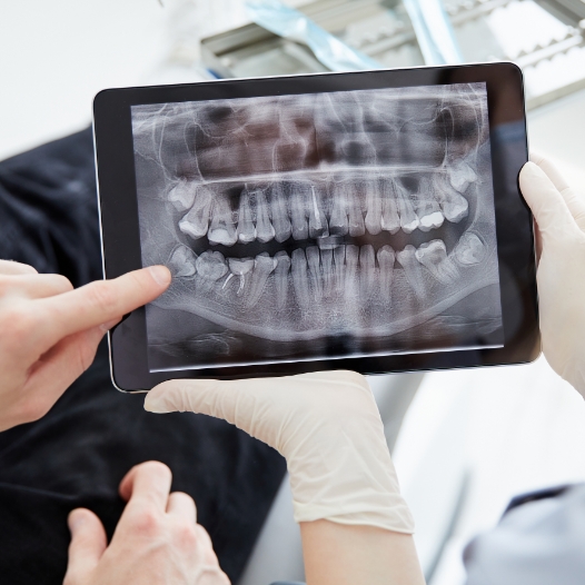 Dentist showing a patient x rays of their teeth on a tablet