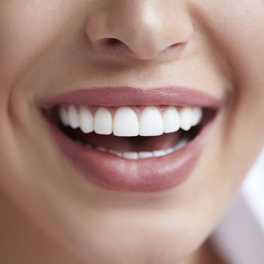 Close up of person smiling with straight white teeth