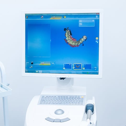 Digital smile impressions on chairside computer