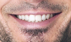Closeup of the front of mouth