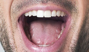 Closeup of the top of an open mouth